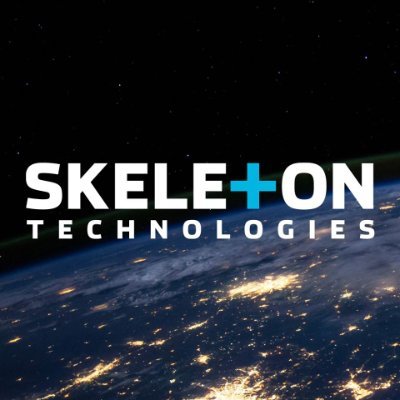 Ultracapacitor Energy Storage Solution | Skeleton Technologies, Estonia